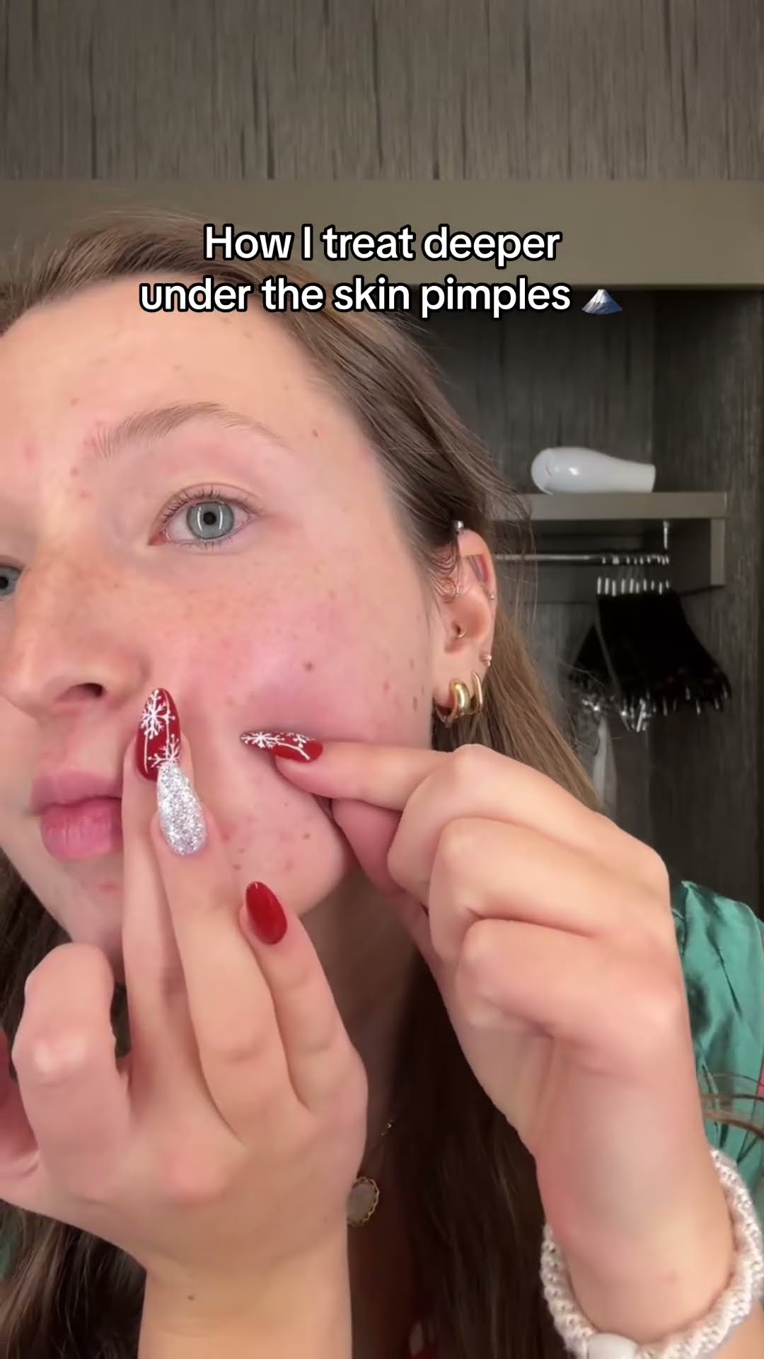 Pimple Nails' Are a Thing Now (We're Sorry) | Glamour